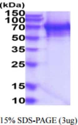 Novus Biologicals&trade;&nbsp;Human TDP1 Recombinant Protein